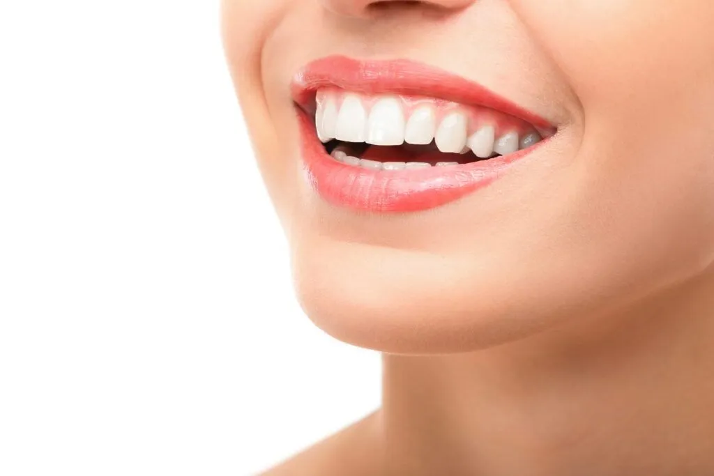 Woman smiling with bright white teeth after porcelain veneers