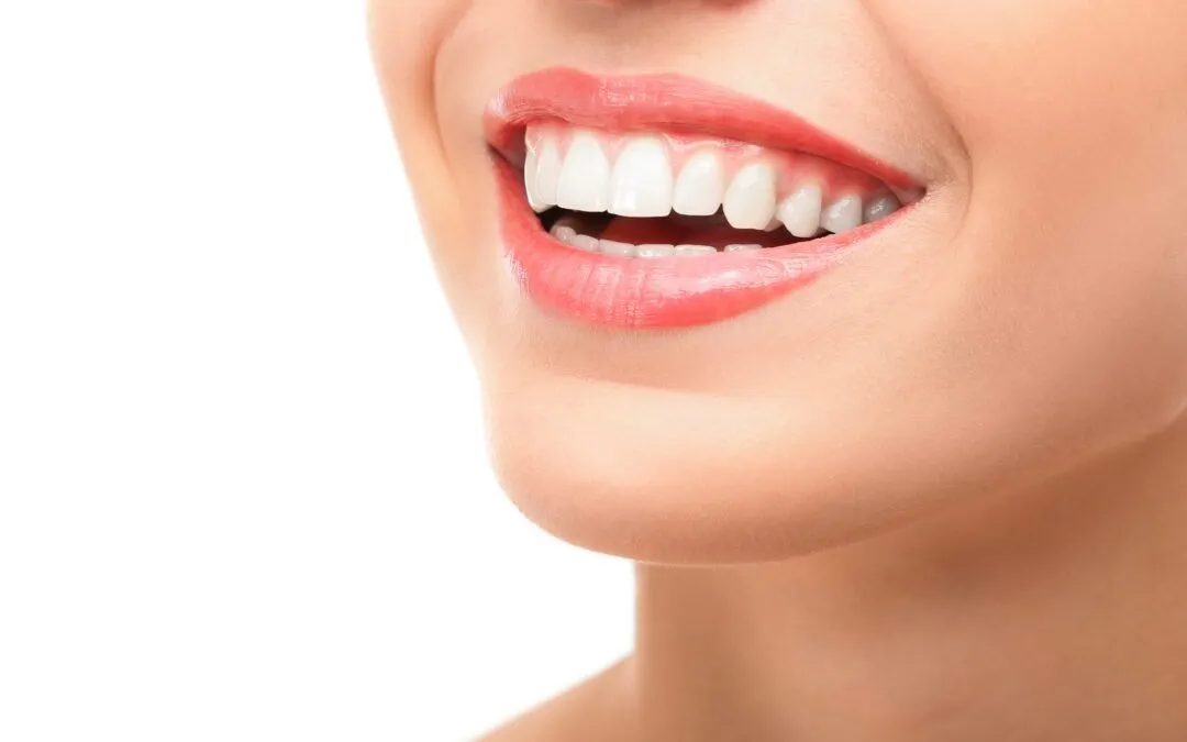 The Truth About Porcelain Veneers: What They Can (and Can’t) Do