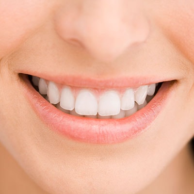 A woman smiling with white teeth