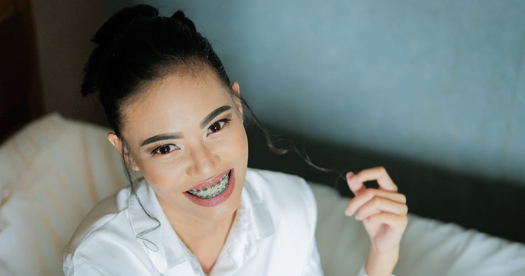Straighten your teeth with a set of braces like these. Photo of a dark-haired woman showing her braces