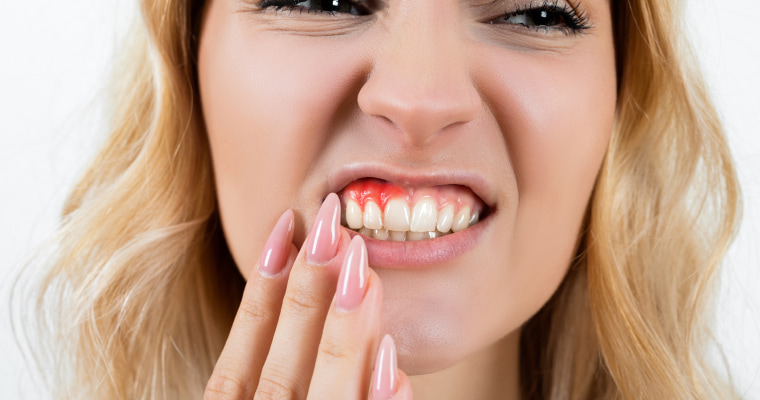 Oral hygiene and dental advice from Harbour Pointe Family Dentistry A female checks her sore gums in a mirror